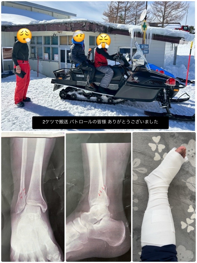 50s主催 山行　初の「骨折者🦴」申し訳ないっす😢